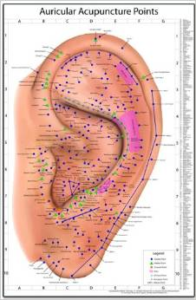 Acupuntura auricular